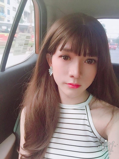 phẫu thuật chuyển giới từ nam sang nữ ảnh 3 phau thuat chuyen gioi tu nam sang nu anh 3