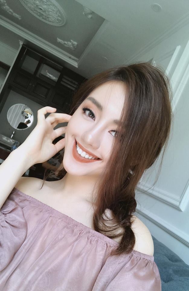 Khánh Linh The Face niềng răng ảnh 3 Khanh Linh The Face nieng rang anh 3