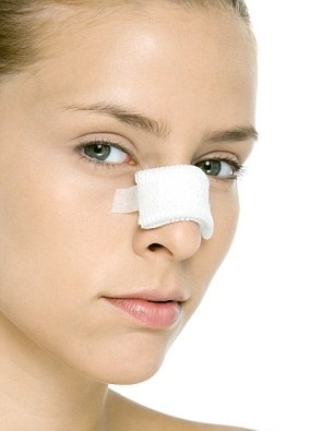 Viem xoang co duoc nang mui anh 2