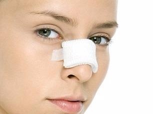 Mac benh viem xoang co nen nang mui? hinh anh