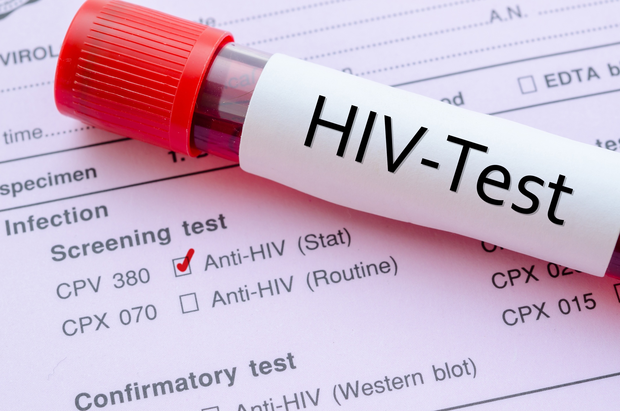 Lây nhiễm HIV ảnh 1 Lay nhiem HIV anh 1