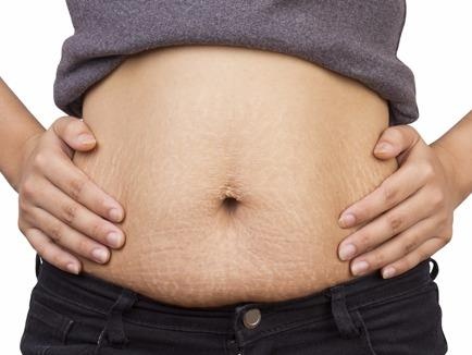 Van muon sinh con co nen hut mo bung? hinh anh