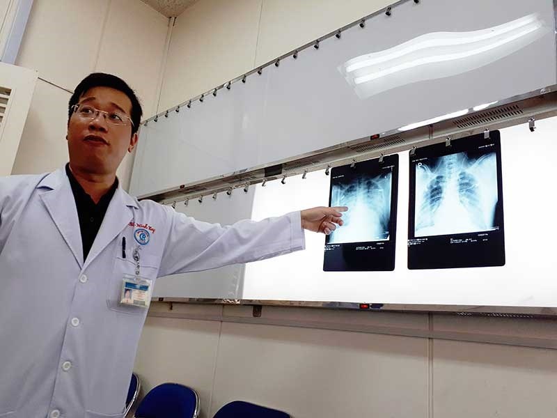 Virus lạ gây chết người ảnh 1 Virus la gay chet nguoi anh 1