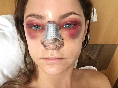 Sun nang mui nao tot nhat? hinh anh