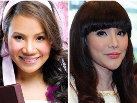 Nhung sao Viet phau thuat tham my 'qua tay' hinh anh