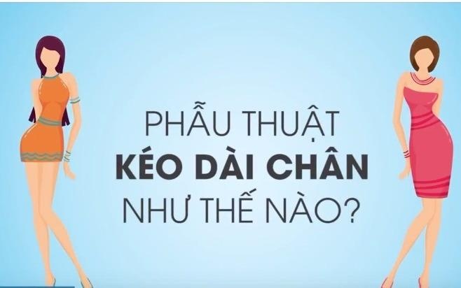 Phau thuat keo dai chan nhu the nao? hinh anh