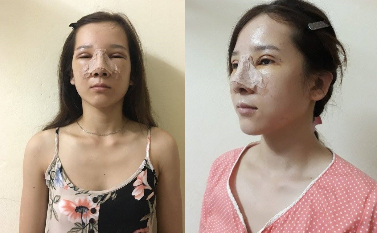 cô gái lột xác nhờ thẩm mỹ ảnh 2 co gai lot xac nho tham my anh 2