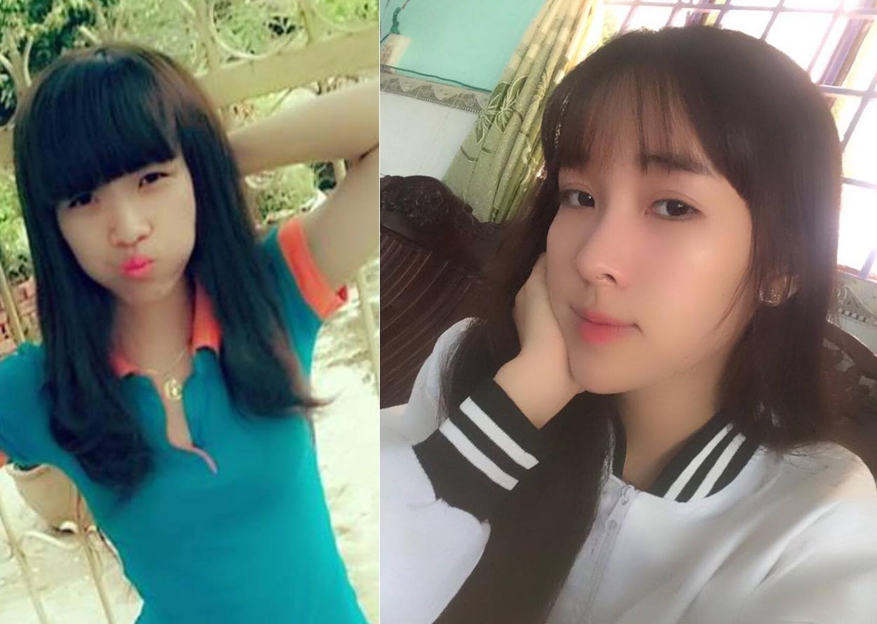 Cô gái 4 lần phẫu thuật thẩm mỹ ảnh 1 Co gai 4 lan phau thuat tham my anh 1