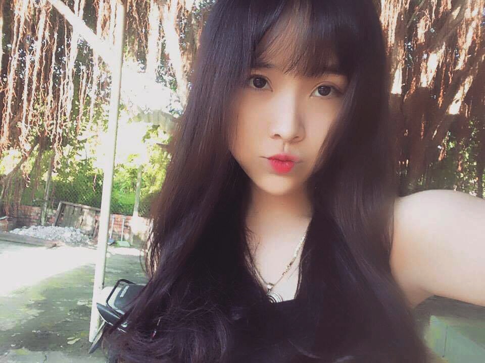 Nu sinh 'day thi thanh cong' sau bon lan phau thuat tham my hinh anh