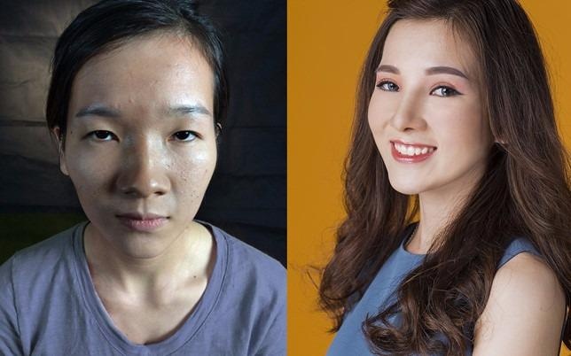5 co gai Viet lot xac sau khi 'dao keo' hinh anh