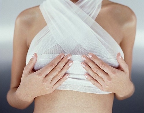 Chọn đường mổ khi nâng ngực ảnh 2 Chon duong mo khi nang nguc anh 2