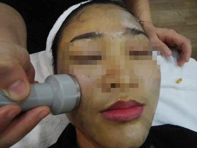 Su that ve lieu phap hut chi, thai doc tren da mat hinh anh