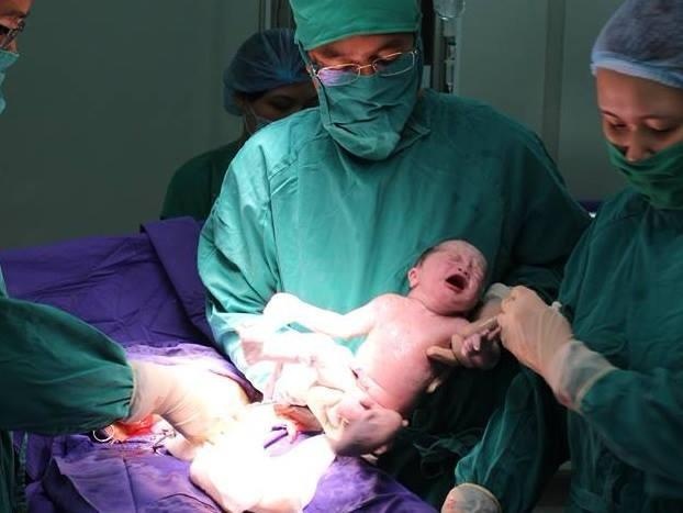 Sinh doi cung trung ra doi nho phuong phap thu tinh ong nghiem hinh anh