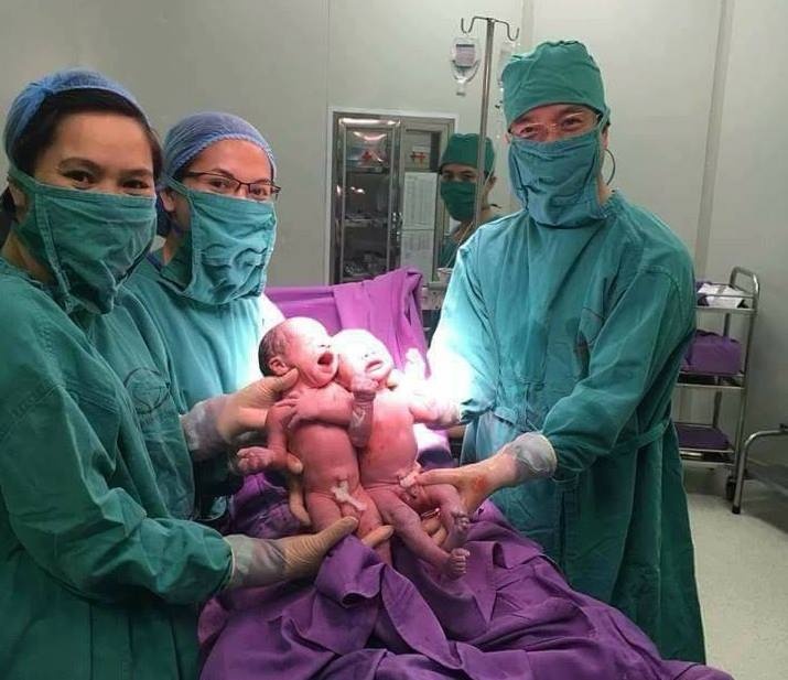 Hai bé sinh đôi cùng trứng nhờ thụ tinh ống nghiệm ảnh 1 Hai be sinh doi cung trung nho thu tinh ong nghiem anh 1