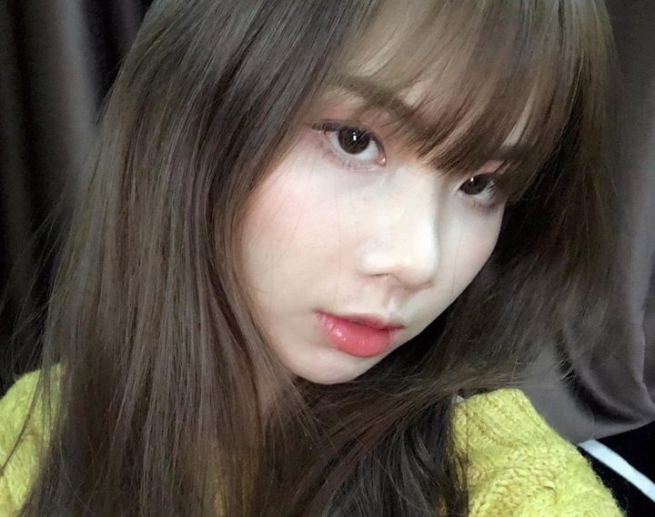 kinh nghiệm phẫu thuật chỉnh hàm hô ảnh 2 kinh nghiem phau thuat chinh ham ho anh 2