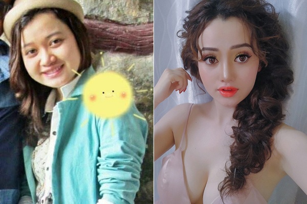 9X so huu guong mat bup be sau khi chi 100 trieu dong 'dao keo' hinh anh