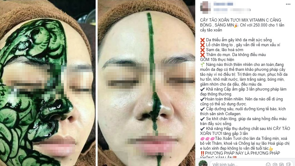 vi kim cấy tảo xoắn ảnh 1 vi kim cay tao xoan anh 1