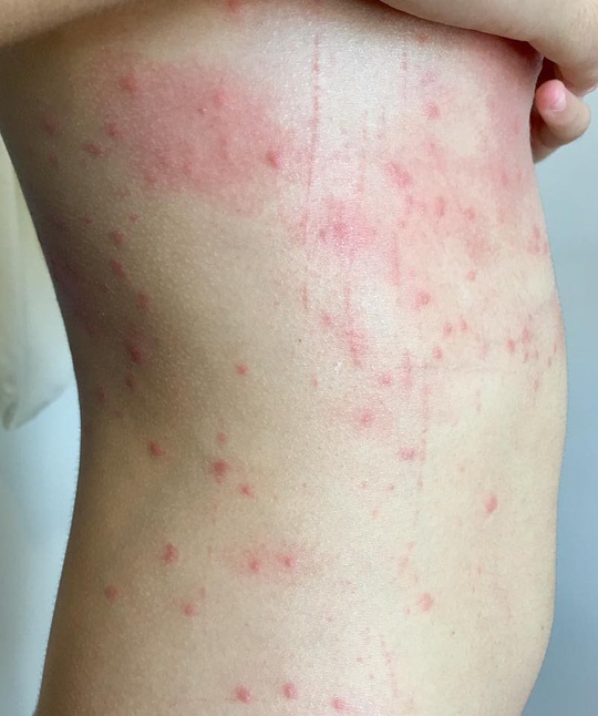 Tam bien Da Nang gay ngua anh 1