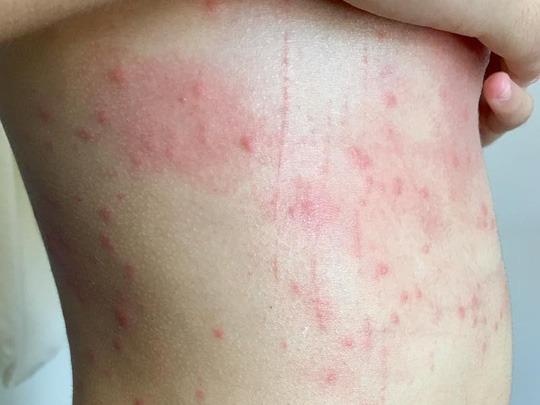 Tam bien Da Nang bi ngua noi dom do ca nguoi? hinh anh