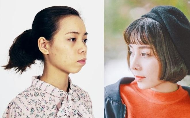 Biến đổi sau phẫu thuật thẩm mỹ ảnh 1 Bien doi sau phau thuat tham my anh 1