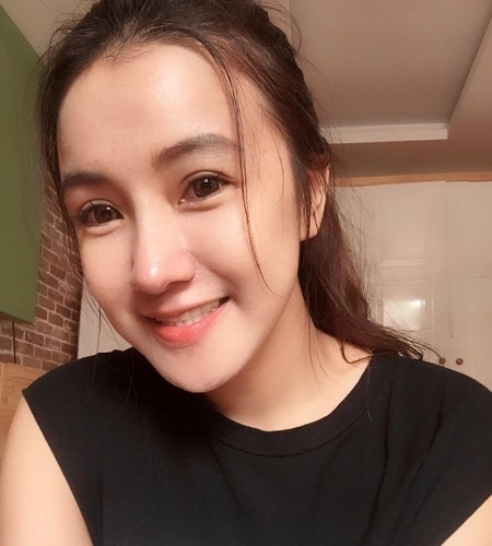 Biến đổi sau phẫu thuật thẩm mỹ ảnh 6 Bien doi sau phau thuat tham my anh 6