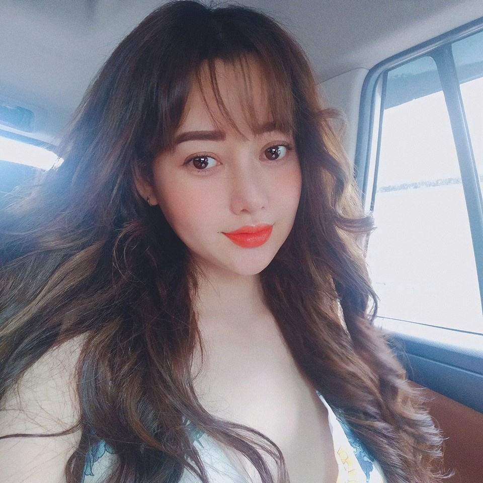 Biến đổi sau phẫu thuật thẩm mỹ ảnh 8 Bien doi sau phau thuat tham my anh 8