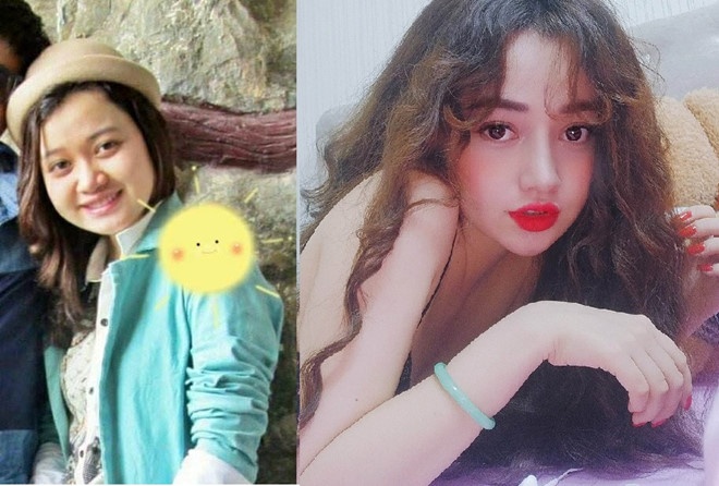 5 co gai thanh hot girl sau khi phau thuat tham my hinh anh