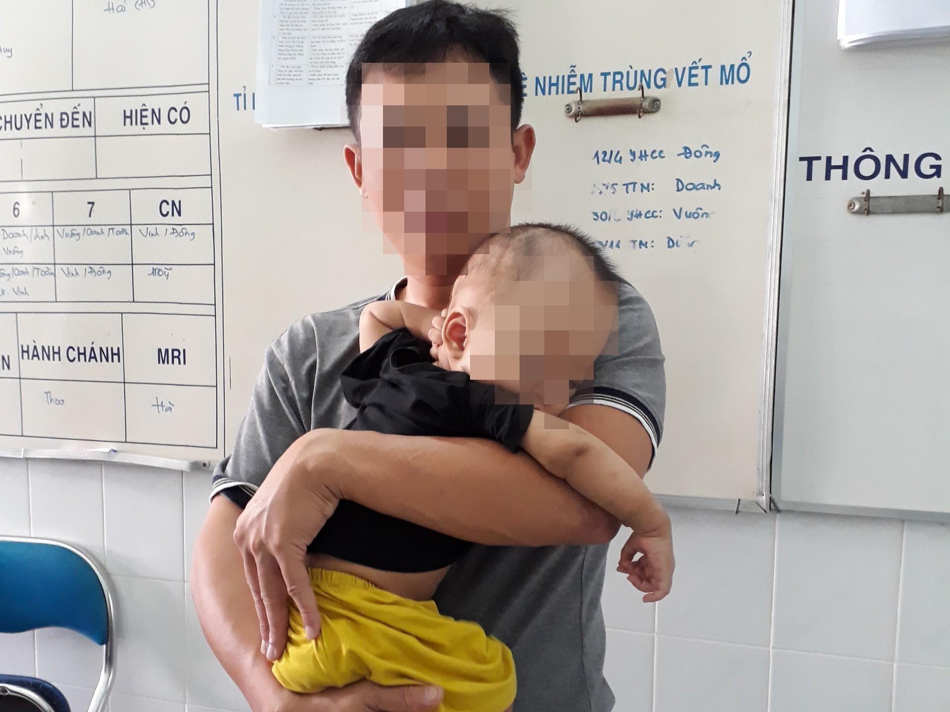 Phau thuat thanh cong cho hai tre bien dang hop so phuc tap hinh anh