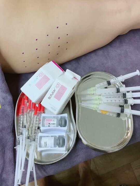 Cô gái không cười được vì tiêm botox ảnh 1 Co gai khong cuoi duoc vi tiem botox anh 1