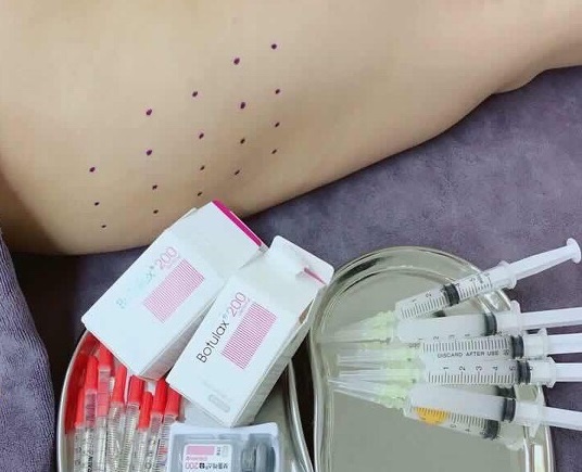 Co gai nhu bup be vo hon sau khi tiem botox lam thon gon mat hinh anh