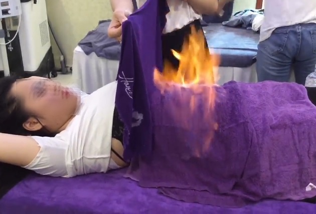 Hỏa liệu pháp ảnh 1 Hoa lieu phap anh 1