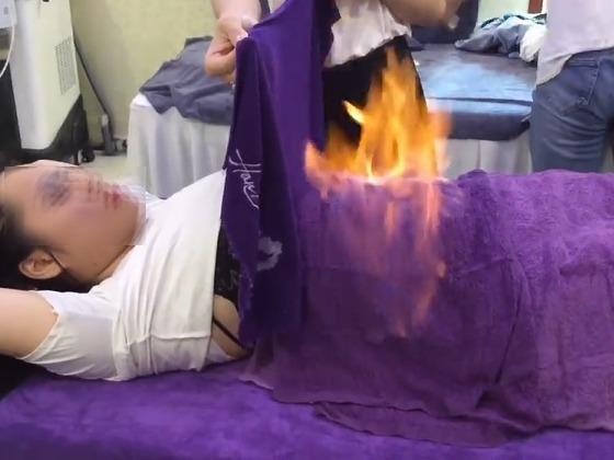 Dot lua giam mo: Phuong phap lam dep chua tung co trong y hoc? hinh anh