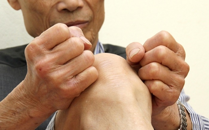 Benh nam gioi kho tranh anh 8