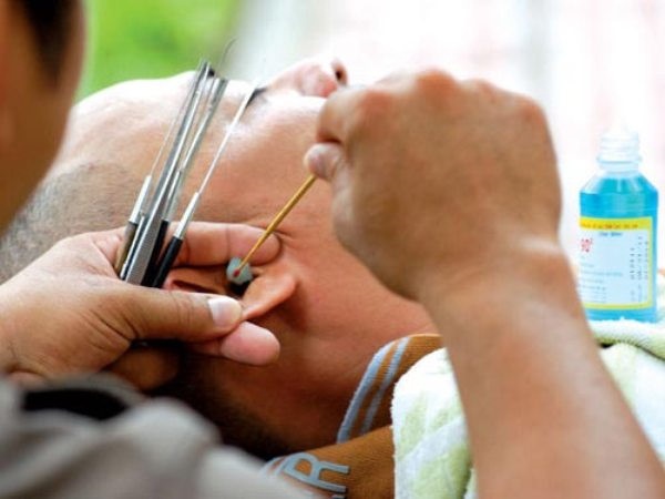 ruoc benh vi lay ray tai anh 1