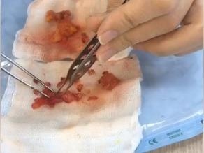 Spa gioi thieu 'mo nhan tao' nhung tiem silicone vao mat khach hang hinh anh