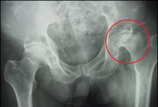 Hoai tu chom xuong dui anh 1