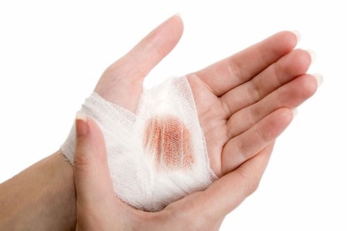 Bảo quản bộ phận bị đứt rời  ảnh 1 Bao quan bo phan bi dut roi anh 1