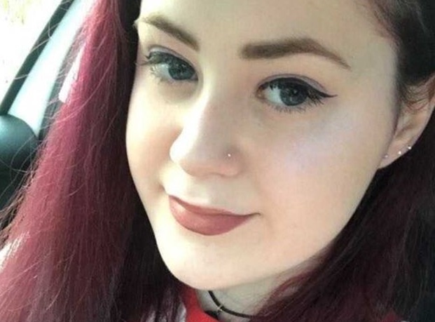 Chung benh bat ngo khien co gai 19 tuoi thay minh nhu ba lao hinh anh