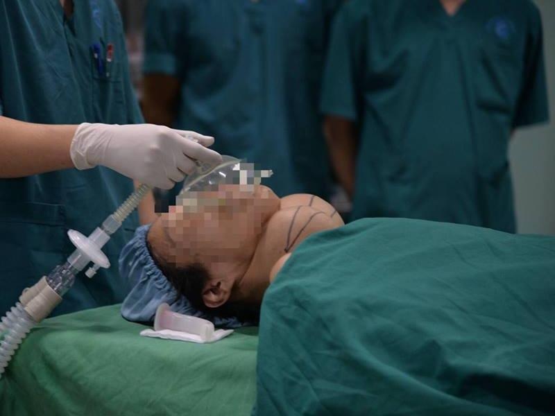 Benh nhan mang khoi u tuyen giap khong lo suot 10 nam hinh anh