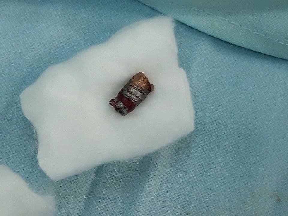 Thanh nien bi dan ban xuyen co anh 1