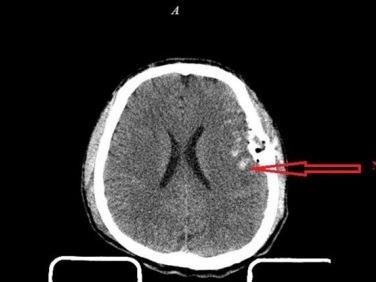 Nguoi dan ong bi dap nao, lun so vi tai nan giao thong hinh anh