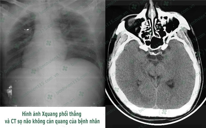Tài xế hôn mê sâu vì quên ăn sáng ảnh 1 Tai xe hon me sau vi quen an sang anh 1