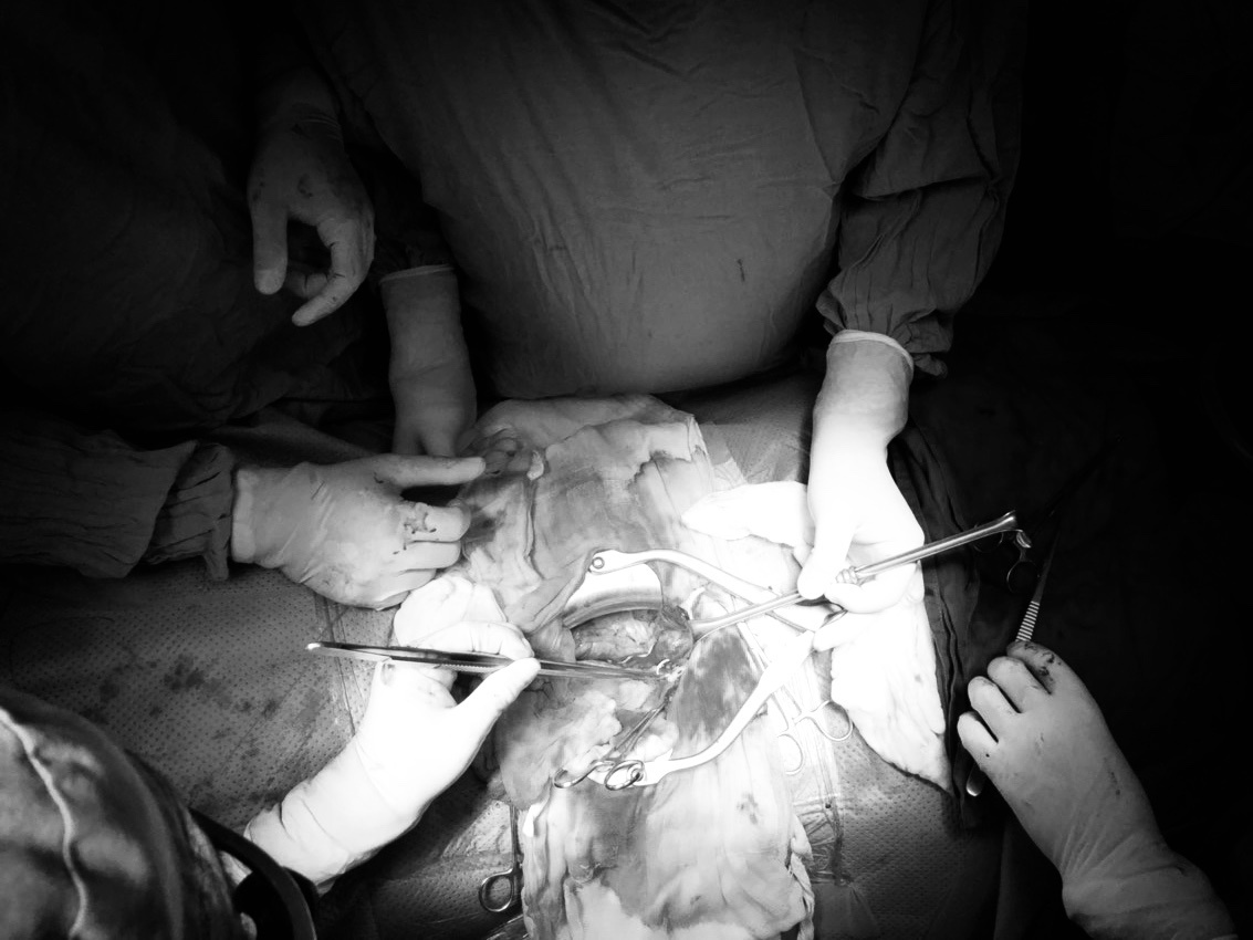 ghép tạng ảnh 4 ghep tang anh 4