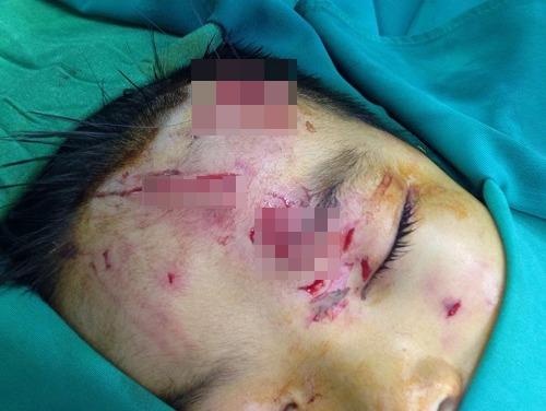 Be trai 7 tuoi bi cho can bien dang mat hinh anh