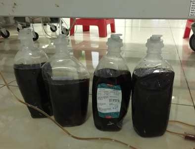 Uống rượu bia ảnh 1 Uong ruou bia anh 1