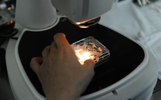 Quy trinh lay va tru dong tinh trung cho nguoi chet hinh anh