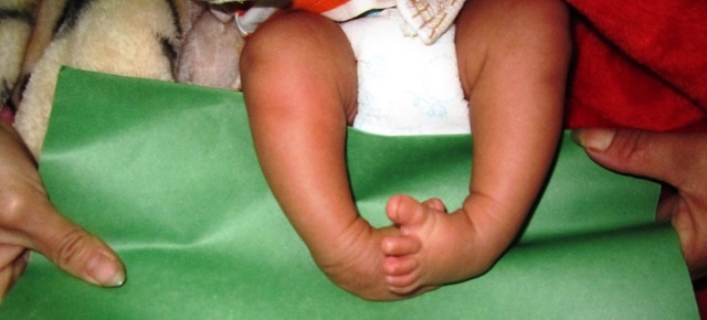 di tat ban chan khoeo anh 1