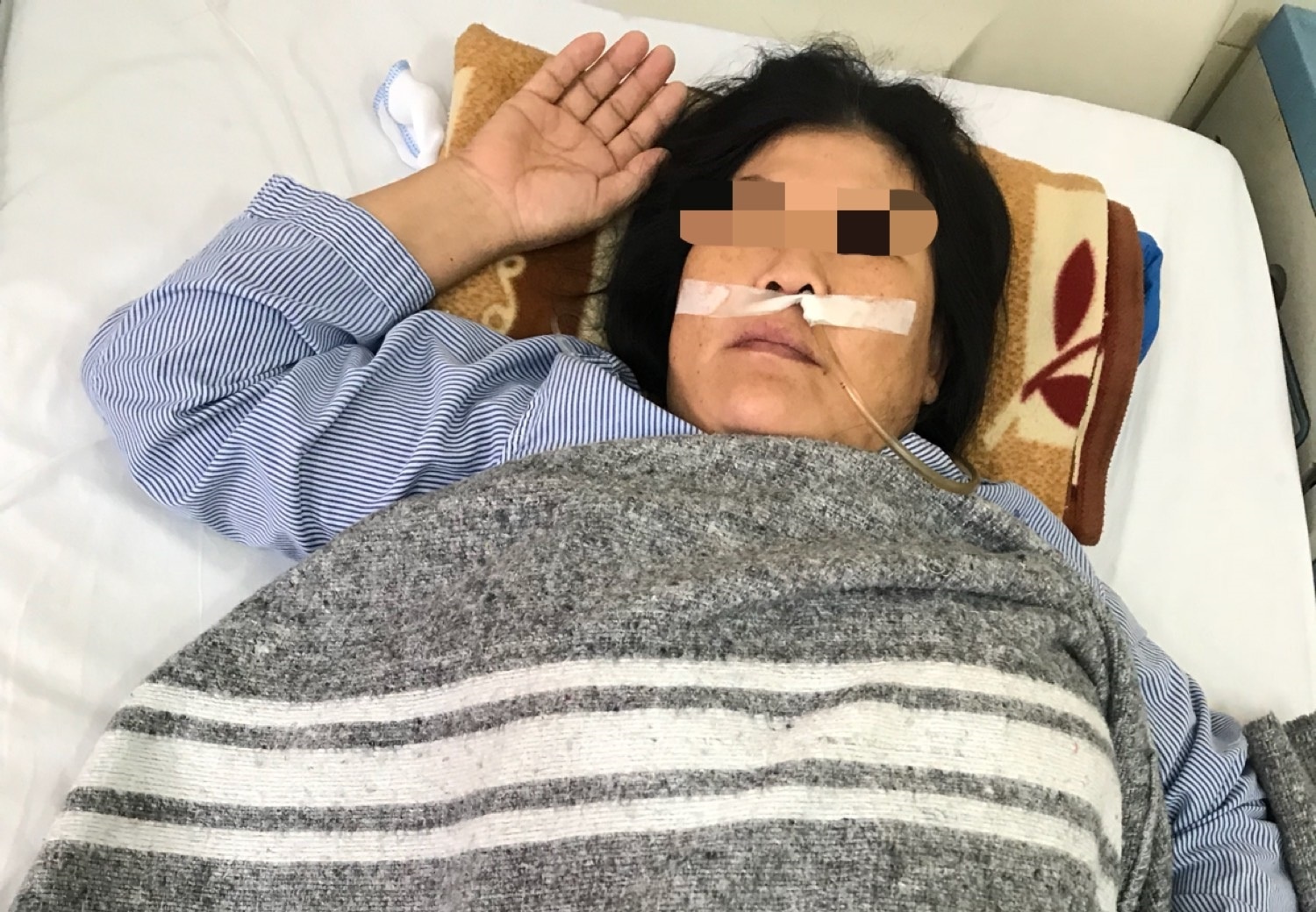 tu y uong thuoc nam dieu tri u thuc quan anh 1