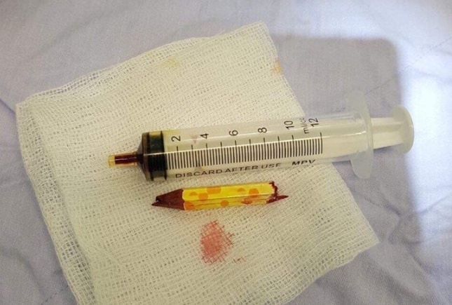 tai nạn do đồ chơi ảnh 1 tai nan do do choi anh 1