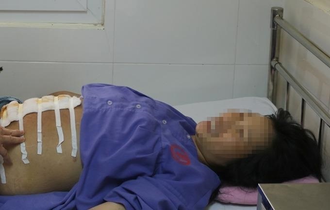 San phu vo oi, thai nhi lot tay ra ngoai hinh anh